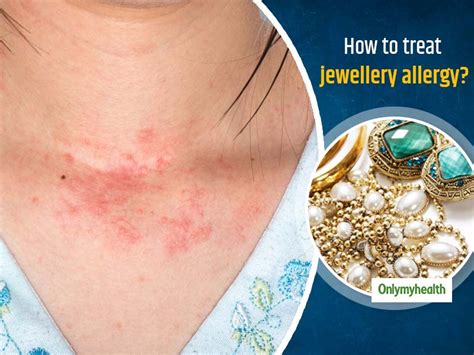 cheapest necklaces that are best for those allergic